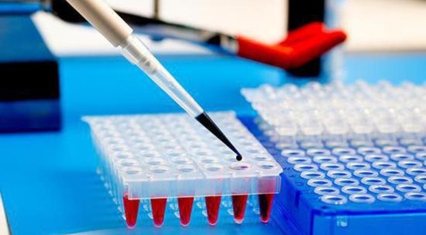У Львові почали робити ІФА-тести на виявлення імунітету до коронаві... У Львові почали робити ІФА-тести на виявлення імунітету до коронавірусу